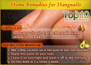 home-remedies-for-hangnails-opt
